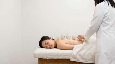 Cupping Therapy in Richmond BC