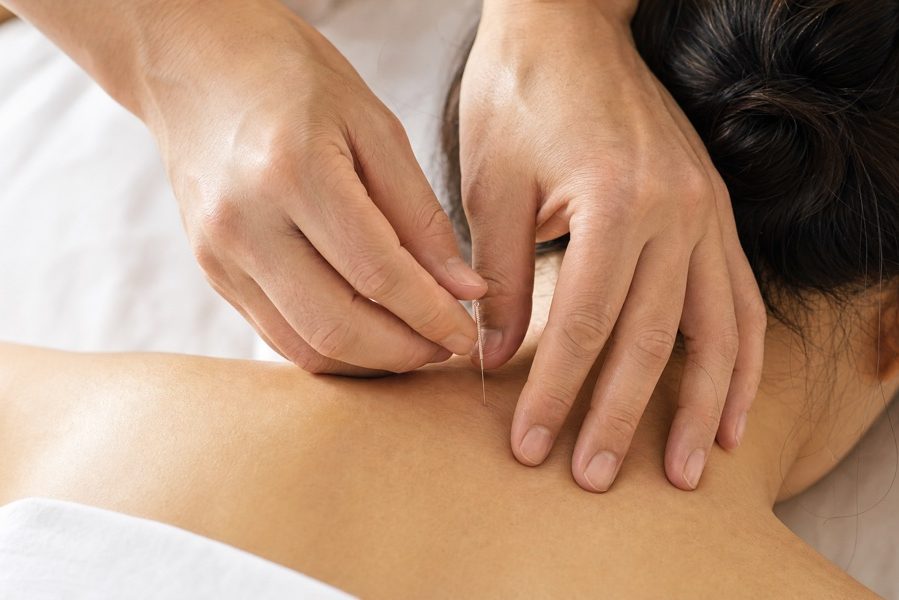 Mandy Tam Acupuncturist ਰਿਚਮੰਡ